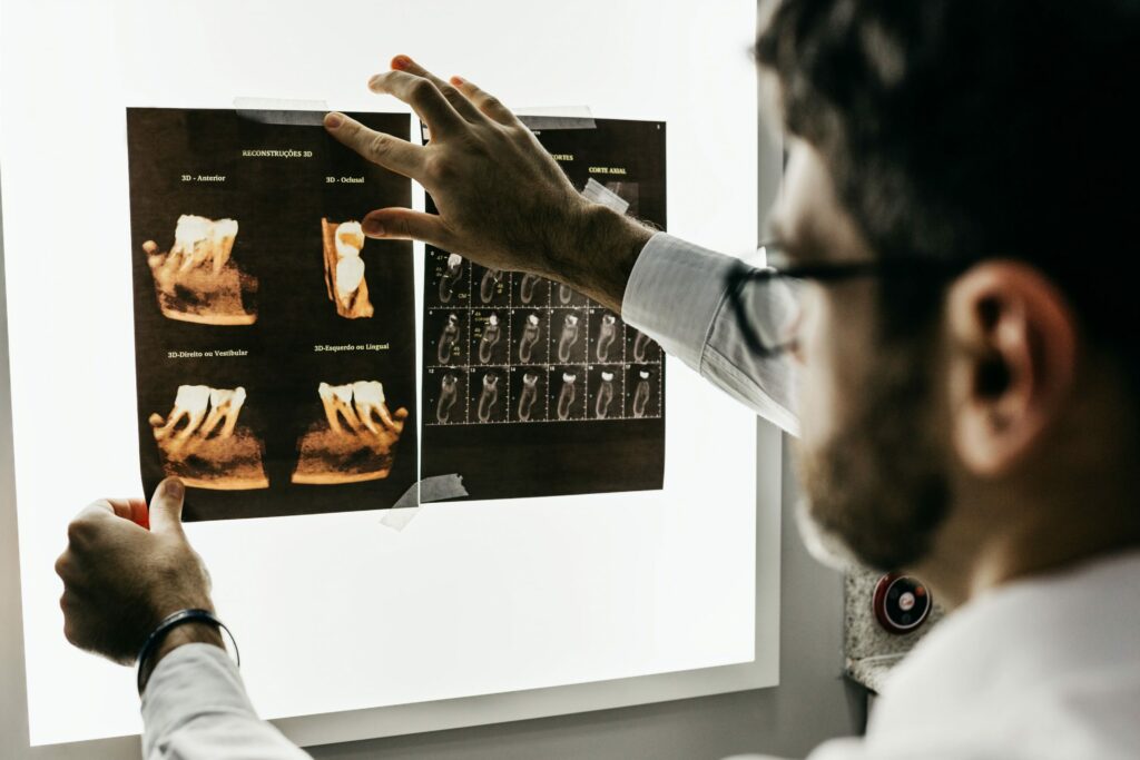 osteonecrosis of the jaw